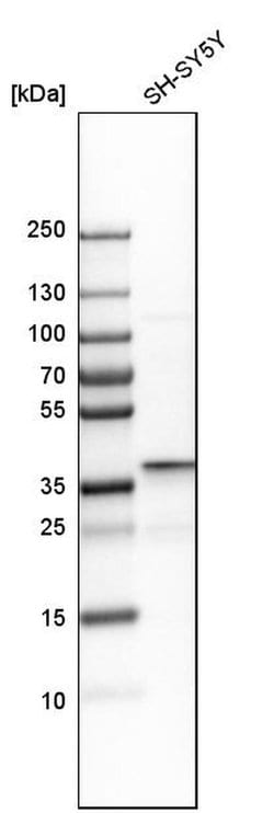 Invitrogen DDAH1 Polyclonal Antibody 100 &mu;L; Unconjugated:Antibodies,