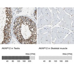 Invitrogen&trade;&nbsp;AKAP12 Polyclonal Antibody