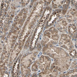 Invitrogen&trade;&nbsp;POLRMT Polyclonal Antibody