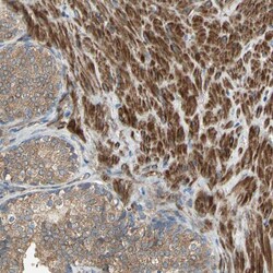 Invitrogen&trade;&nbsp;POLRMT Polyclonal Antibody