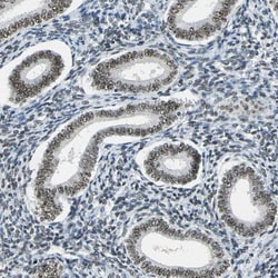 Invitrogen ADNP Polyclonal Antibody 100 &mu;L; Unconjugated:Antibodies,