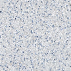 Invitrogen ADNP Polyclonal Antibody 100 &mu;L; Unconjugated:Antibodies,