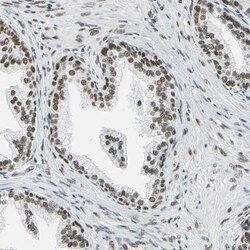 Invitrogen ADNP Polyclonal Antibody 100 &mu;L; Unconjugated:Antibodies,