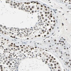 Invitrogen ADNP Polyclonal Antibody 100 &mu;L; Unconjugated:Antibodies,