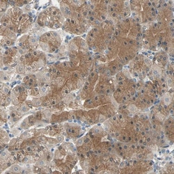 Invitrogen Cdc42EP1 Polyclonal Antibody 100 &mu;L; Unconjugated:Antibodies,