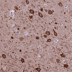 Invitrogen PIAS3 Polyclonal Antibody 100 &mu;L; Unconjugated:Antibodies,