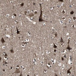 Invitrogen PPP1R13B Polyclonal Antibody 100 &mu;L; Unconjugated:Antibodies,