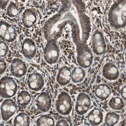 Invitrogen PPP1R13B Polyclonal Antibody 100 &mu;L; Unconjugated:Antibodies,