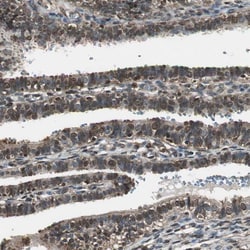 Invitrogen PPP1R13B Polyclonal Antibody 100 &mu;L; Unconjugated:Antibodies,