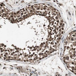 Invitrogen PPP1R13B Polyclonal Antibody 100 &mu;L; Unconjugated:Antibodies,