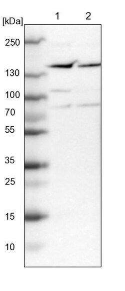 Invitrogen PPP1R13B Polyclonal Antibody 100 &mu;L | Buy Online | Invitrogen&trade; | Fisher Scientific