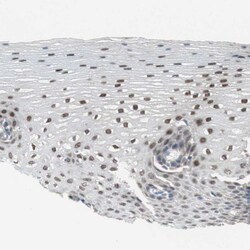 Invitrogen&trade;&nbsp;GRHL1 Polyclonal Antibody