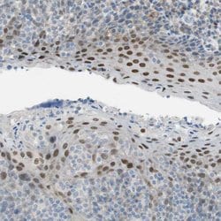 Invitrogen&trade;&nbsp;GRHL1 Polyclonal Antibody