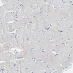 Invitrogen&trade;&nbsp;GRHL1 Polyclonal Antibody