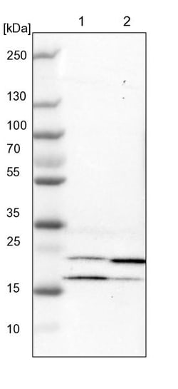 Invitrogen Adenylate Kinase 1 Polyclonal Antibody 100 &mu;L; Unconjugated:Antikörper