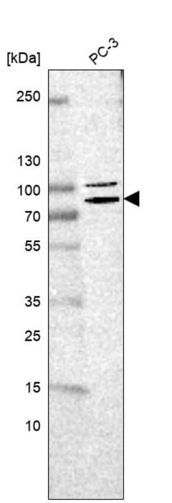 Invitrogen ECD Polyclonal Antibody 100 &mu;L; Unconjugated:Antibodies,
