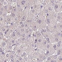 Invitrogen&trade;&nbsp;ACTRT2 Polyclonal Antibody