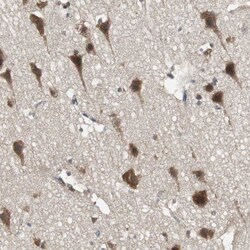 Invitrogen PFDN1 Polyclonal Antibody 100 &mu;L; Unconjugated:Antibodies,
