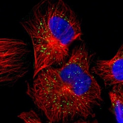 Invitrogen JTB Polyclonal Antibody 100 &mu;L; Unconjugated:Antibodies,