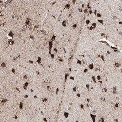 Invitrogen TCP-1 gamma Polyclonal Antibody 100 &mu;L; Unconjugated:Antibodies,