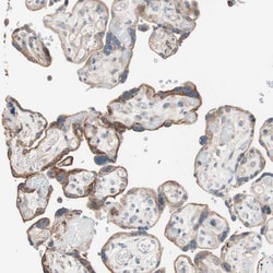 Invitrogen TCP-1 gamma Polyclonal Antibody 100 &mu;L; Unconjugated:Antibodies,