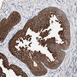 Invitrogen TCP-1 gamma Polyclonal Antibody 100 &mu;L; Unconjugated:Antibodies,