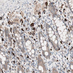 Invitrogen TCP-1 gamma Polyclonal Antibody 100 &mu;L; Unconjugated:Antibodies,