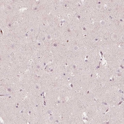 Invitrogen ACACB Polyclonal Antibody 100 &mu;L; Unconjugated:Anticorps,