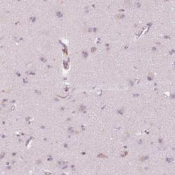 Invitrogen ACACB Polyclonal Antibody 100 &mu;L; Unconjugated:Anticorps,