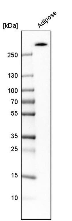 Invitrogen ACACB Polyclonal Antibody 100 &mu;L; Unconjugated:Anticorps,