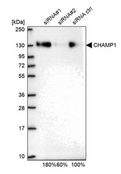 Invitrogen CHAMP1 Polyclonal Antibody 100 &mu;L; Unconjugated:Antibodies,