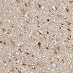 Invitrogen&trade;&nbsp;ZNF96 Polyclonal Antibody