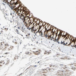 Invitrogen&trade;&nbsp;FAM189B Polyclonal Antibody