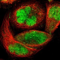 Invitrogen ZKSCAN1 Polyclonal Antibody 100 &mu;L; Unconjugated:Antibodies,