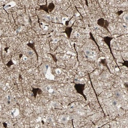 Invitrogen ZKSCAN1 Polyclonal Antibody 100 &mu;L; Unconjugated:Antibodies,
