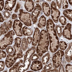 Invitrogen ZNF445 Polyclonal Antibody 100 &mu;L; Unconjugated:Antibodies,