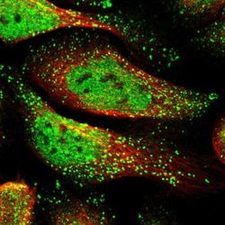 Invitrogen RAD1 Polyclonal Antibody 100 &mu;L; Unconjugated:Antibodies,