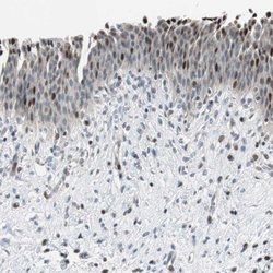 Invitrogen RAD1 Polyclonal Antibody 100 &mu;L; Unconjugated:Antibodies,