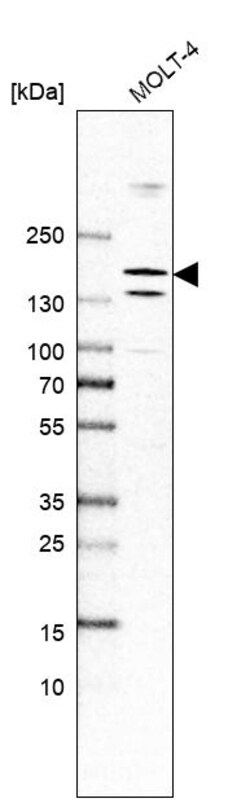 Invitrogen PAXIP1 Polyclonal Antibody 100 &mu;L | Buy Online | Invitrogen&trade; | Fisher Scientific