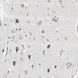 Invitrogen PSMB4 Polyclonal Antibody 100 &mu;L; Unconjugated:Antibodies,