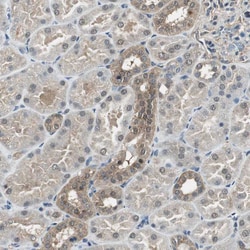 Invitrogen PSMB4 Polyclonal Antibody 100 &mu;L; Unconjugated:Antibodies,