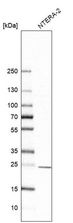 Invitrogen PSMB4 Polyclonal Antibody 100 &mu;L; Unconjugated:Antibodies,