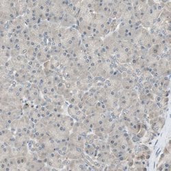Invitrogen PSMD8 Polyclonal Antibody 100 &mu;L; Unconjugated:Antibodies,