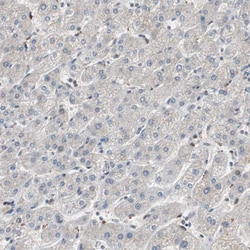 Invitrogen POLH Polyclonal Antibody 100 &mu;L; Unconjugated:Antibodies,