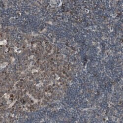 Invitrogen POLH Polyclonal Antibody 100 &mu;L; Unconjugated:Antibodies,