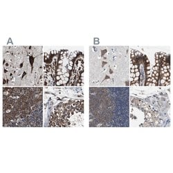 Invitrogen USP10 Polyclonal Antibody 100 &mu;L; Unconjugated:Antibodies,