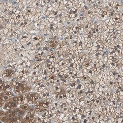 FADS2 Polyclonal Antibody:Antibodies, Polyclonal