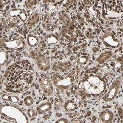 Invitrogen USP42 Polyclonal Antibody 100 &mu;L; Unconjugated:Antibodies,