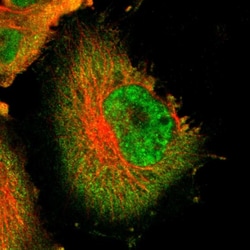 USP5 Polyclonal Antibody:Antibodies, Polyclonal