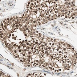 USP5 Polyclonal Antibody:Antibodies, Polyclonal